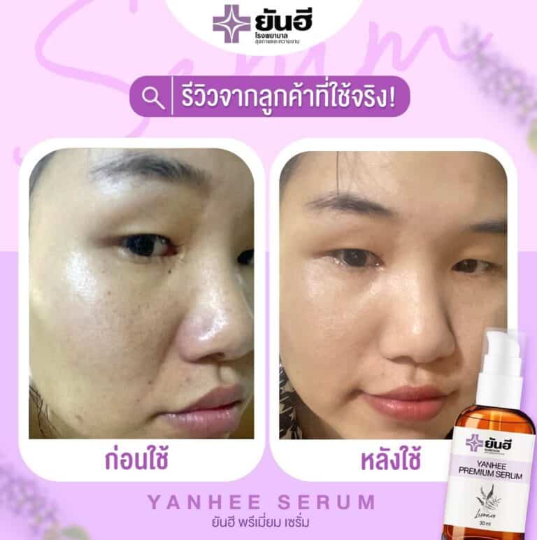 Yanhee Premium ๒๑๐๖๒๓ 21