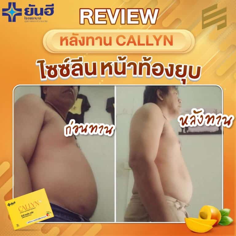 LINE ALBUM รีวิว ยันฮี คอลลีน พลัส 230322 10 1