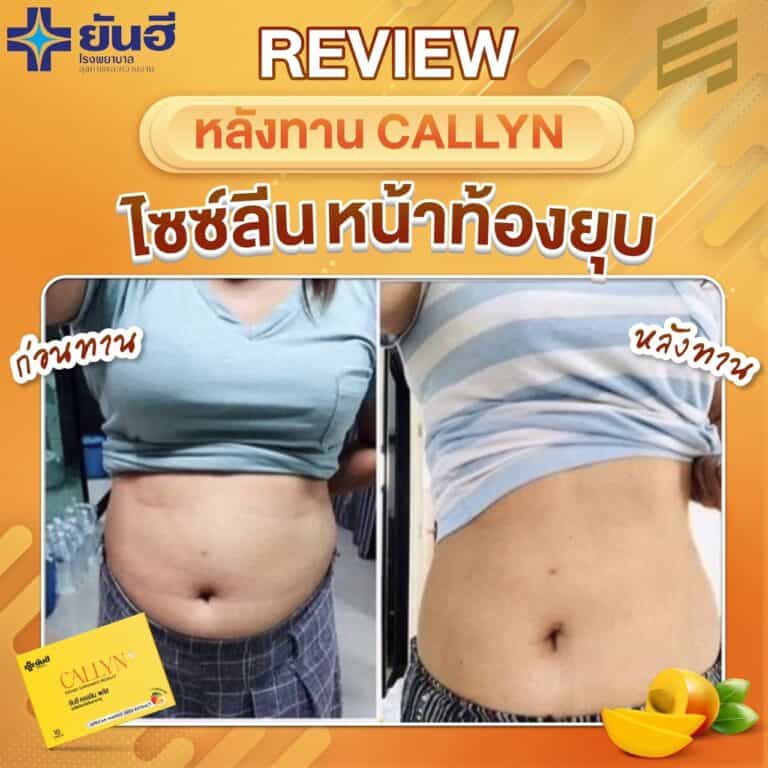 LINE ALBUM รีวิว ยันฮี คอลลีน พลัส 230322 11 1