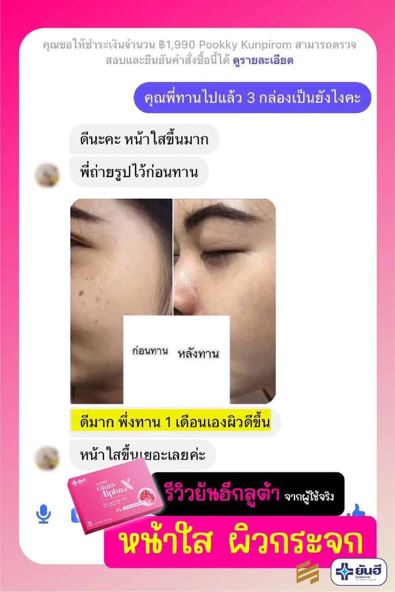 Best Sale Yanhee Gluta Alpha X ยันฮี กลูต้า อัลฟ่า เอ็กซ์ 9 YanheeGlutaAlphaX ยันอีกลูต้าอัลฟ่าเอ็กซ์ กลูต้าผิวขาว
