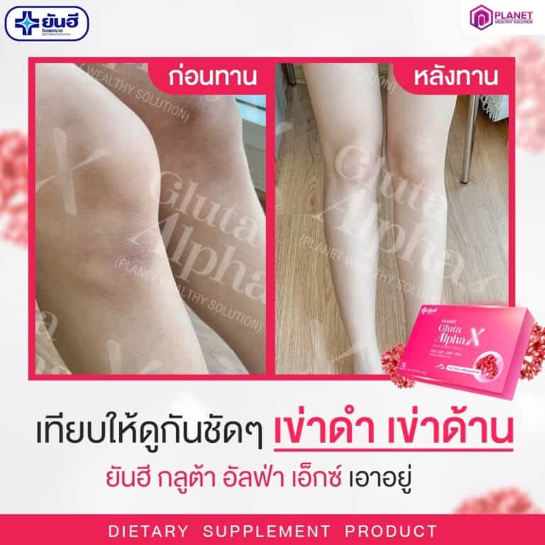 อาหารเสริมผิวขาวอมชมพู