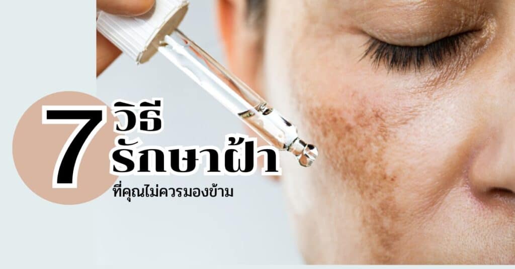 7-วิธีรักษาฝ้าที่คุณไม่ควรมองข้าม