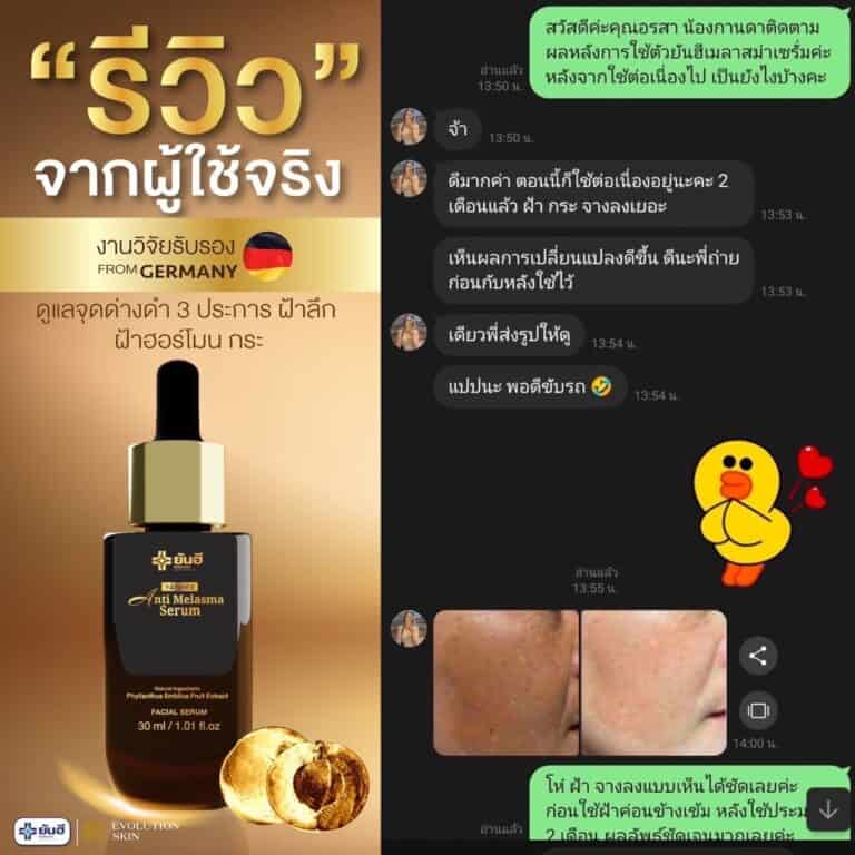 LINE ALBUM รีวิว แอนตี้ มาลาสม่า 231123 10