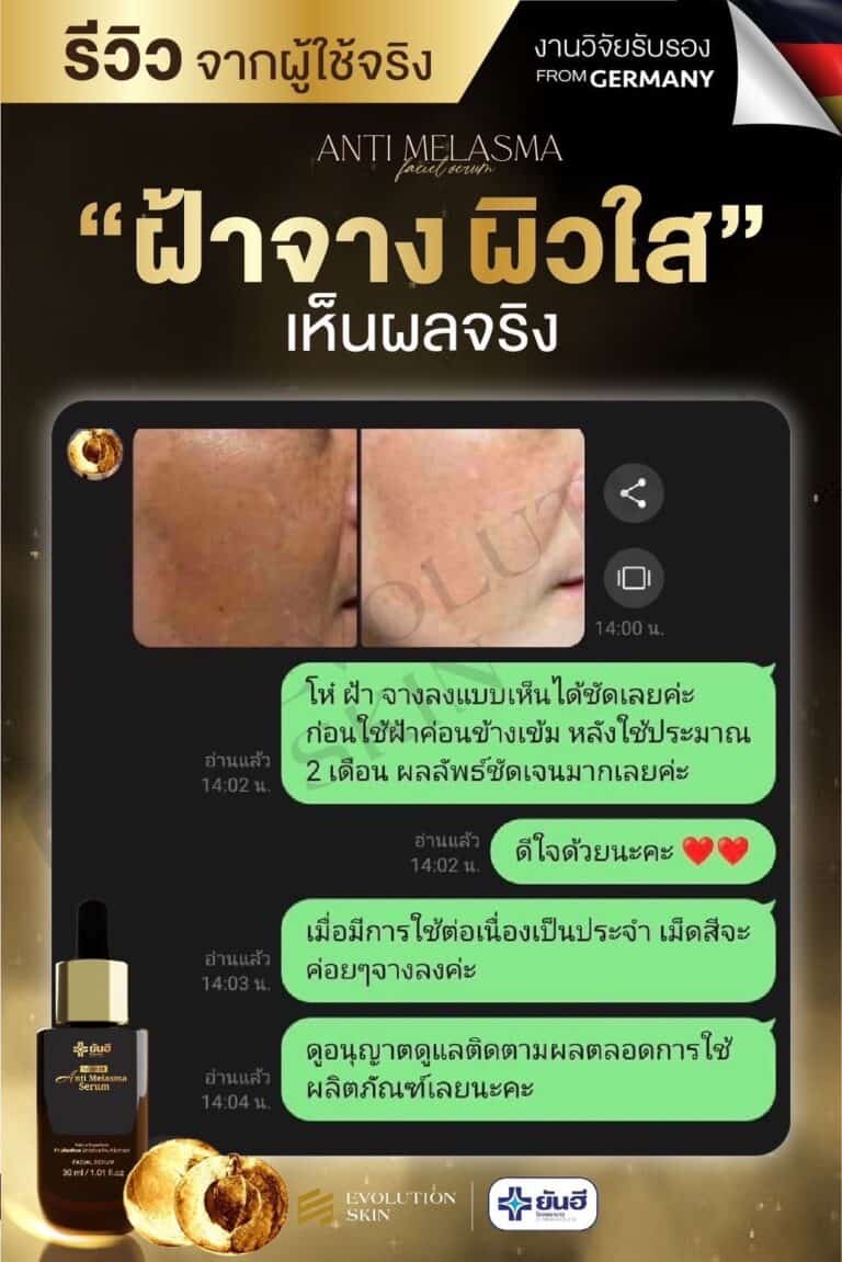 LINE ALBUM รีวิว แอนตี้ มาลาสม่า 231123 12