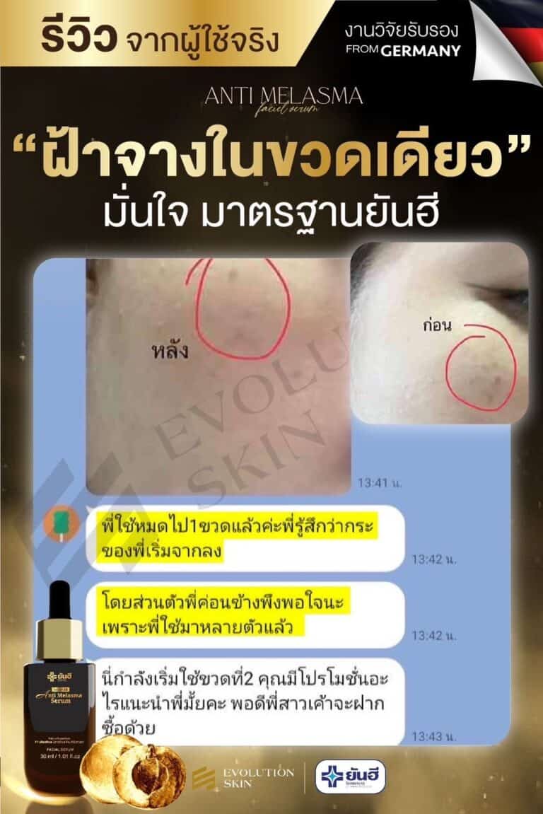 LINE ALBUM รีวิว แอนตี้ มาลาสม่า 231123 17