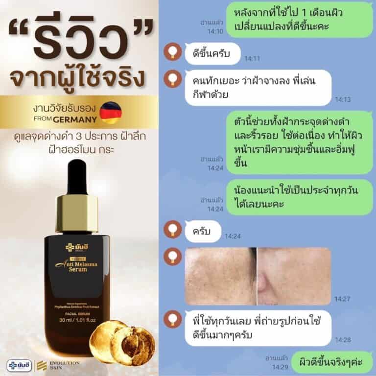 LINE ALBUM รีวิว แอนตี้ มาลาสม่า 231123 8