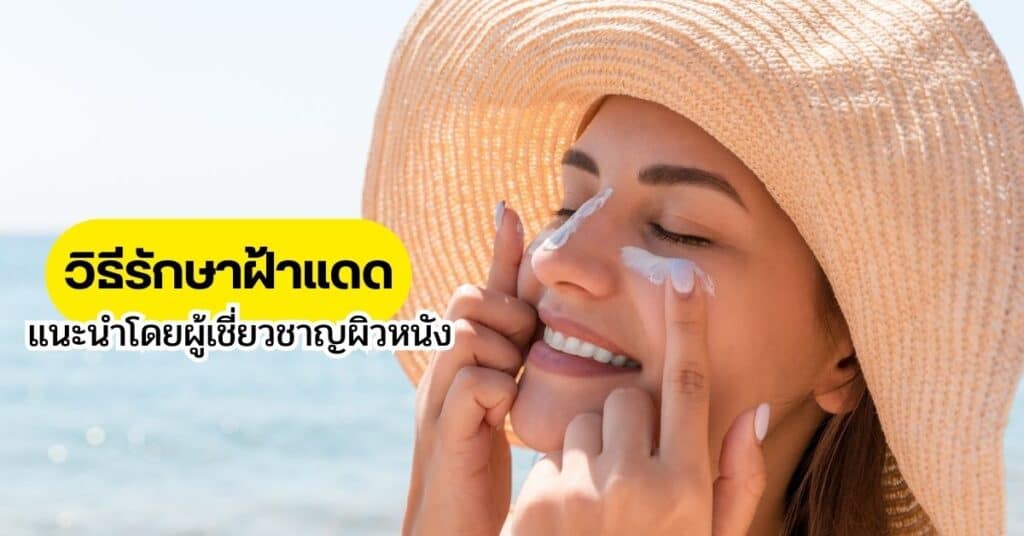 วิธีรักษาฝ้าแดด แนะนำโดยผู้เชี่ยวชาญผิวหนัง