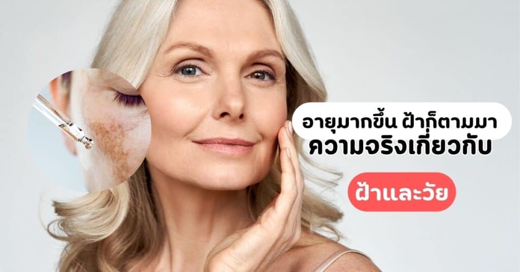 อายุมากขึ้น ฝ้าก็ตามมา ความจริงเกี่ยวกับ ฝ้าและวัย