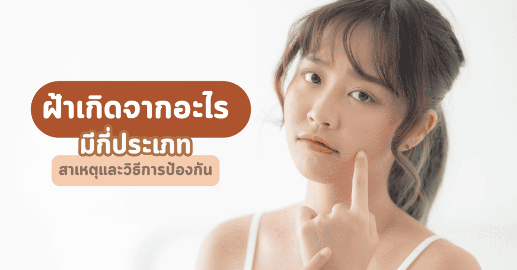 ฝ้าเกิดจากอะไร มีกี่ประเภท สาเหตุและวิธีการป้องกัน 25 ฝ้าเกิดจากอะไร