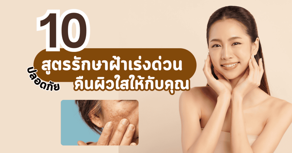 10 สูตรรักษาฝ้าเร่งด่วน ปลอดภัย คืนผิวหน้าสวยใสให้กับคุณ