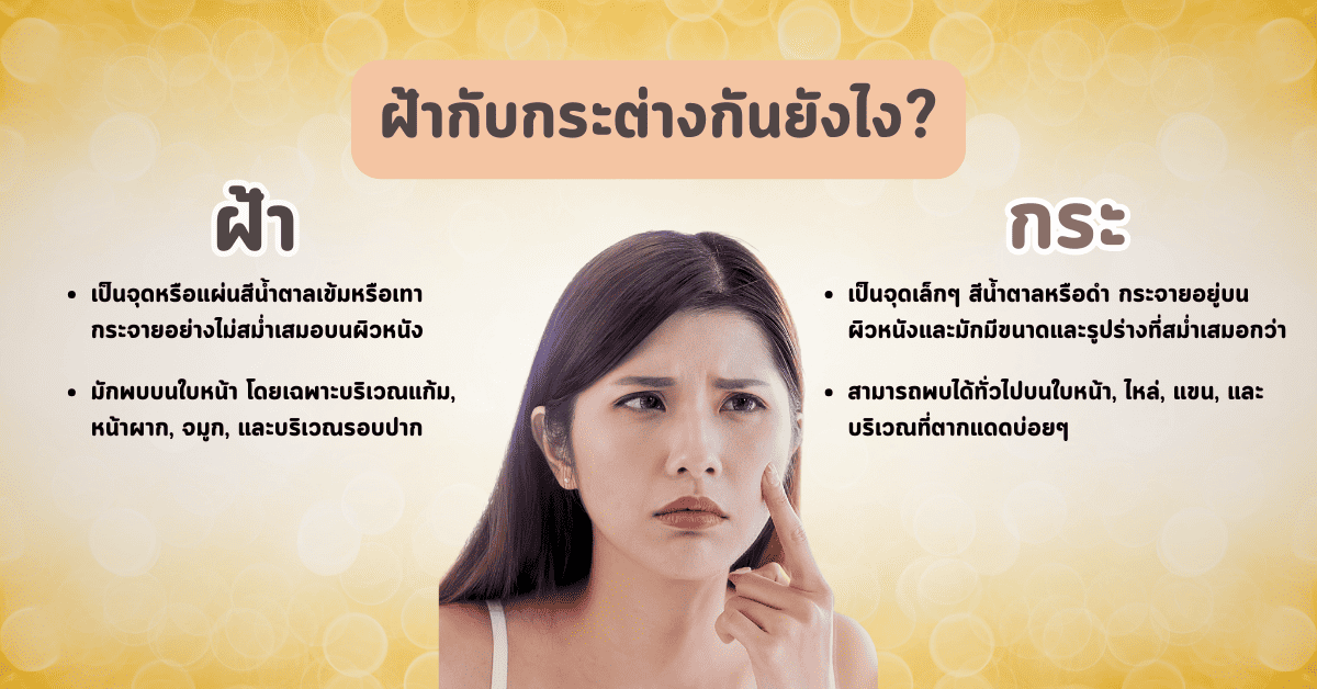 ฝ้าเกิดจากอะไร มีกี่ประเภท สาเหตุและวิธีการป้องกัน 3 2 6