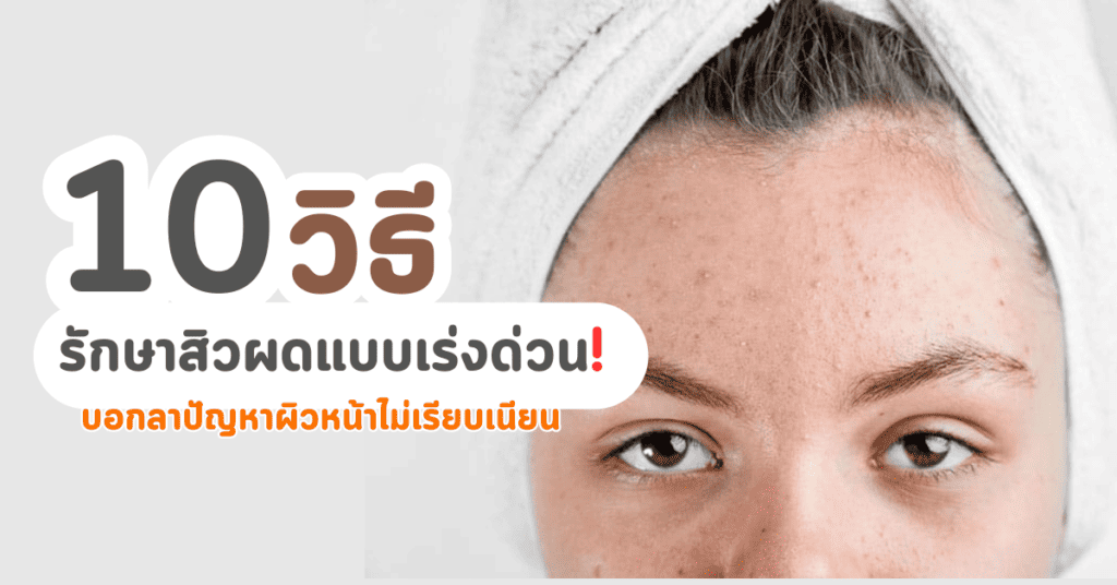 วิธีรักษาสิวผดแบบเร่งด่วน