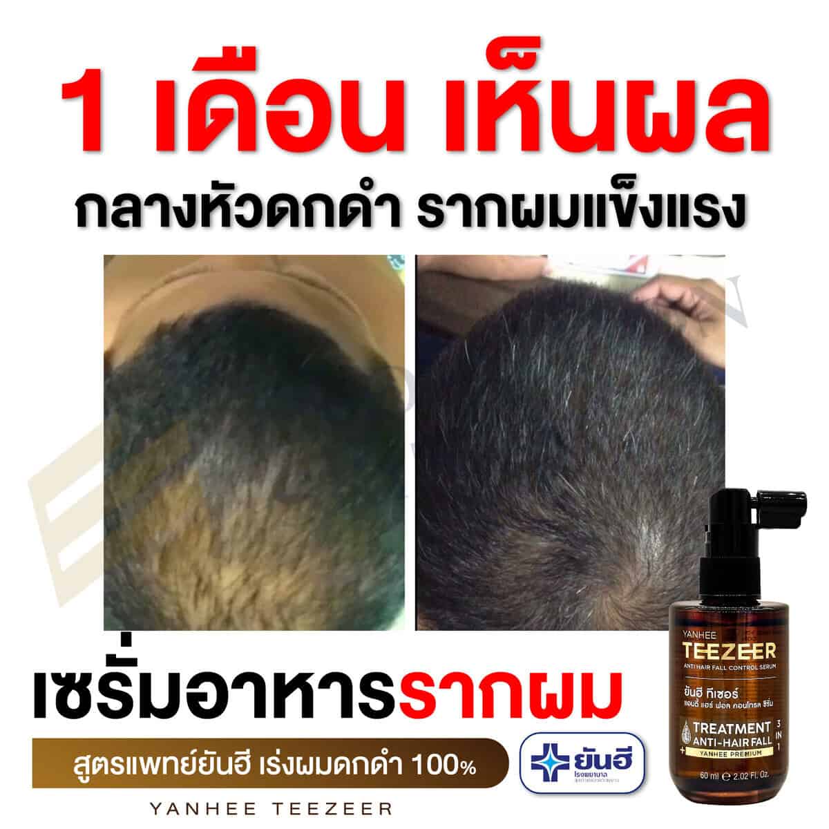 รีวิว 1 เดือนเห็นผล