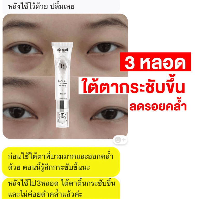 REVIEWEYE27 05 0
