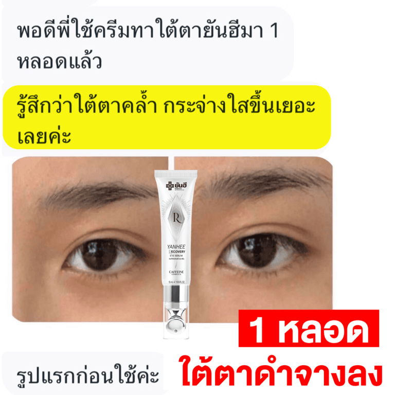 REVIEWEYE27 08 0