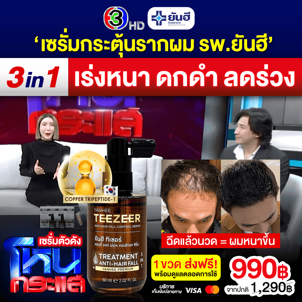 Best Sale Promotion โหนกระแส Yanhee Teezeer 6 Best Sale Promotion โหนกระแส Yanhee Teezeer - Image 6