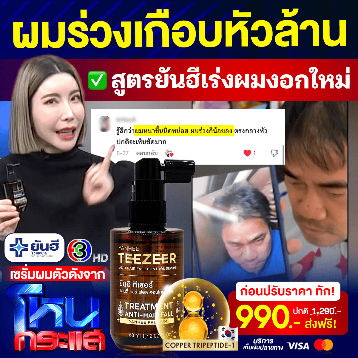 Best Sale Promotion โหนกระแส Yanhee Teezeer 9 Best Sale Promotion โหนกระแส Yanhee Teezeer - Image 9