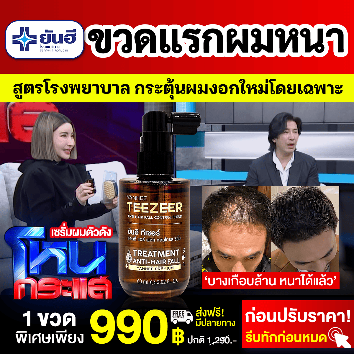 Best Sale Promotion โหนกระแส Yanhee Teezeer 10 Best Sale Promotion โหนกระแส Yanhee Teezeer - Image 10