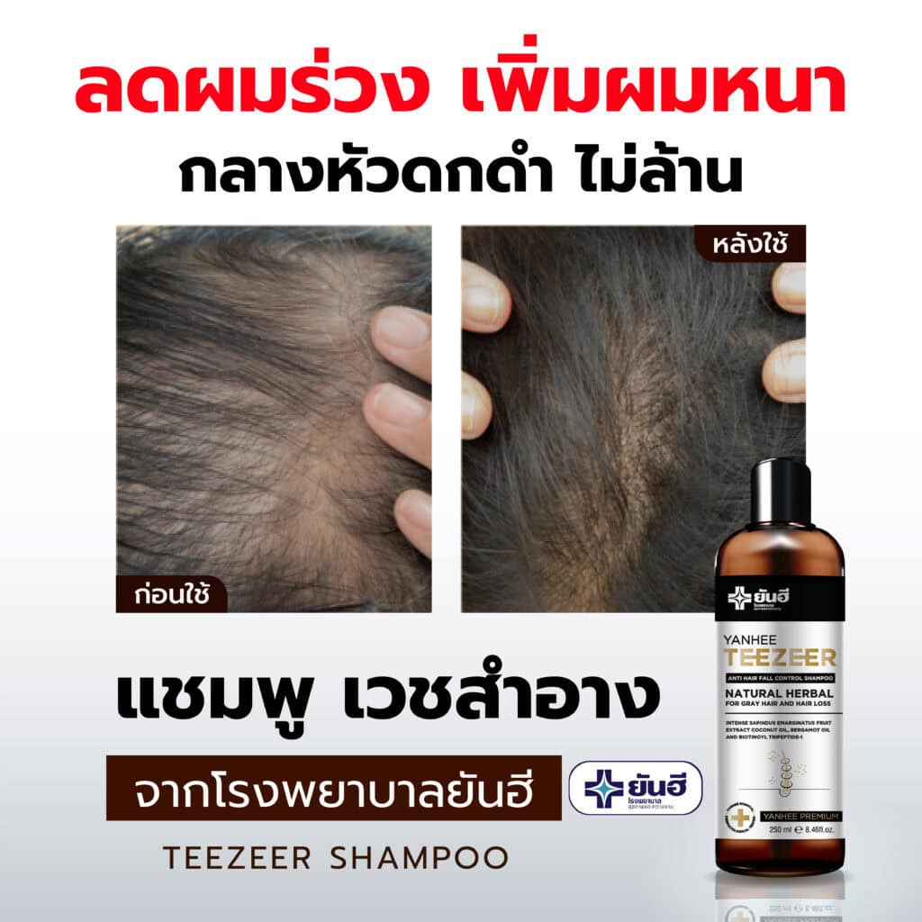 BEFORE AFTER SHAMPOO 01 0