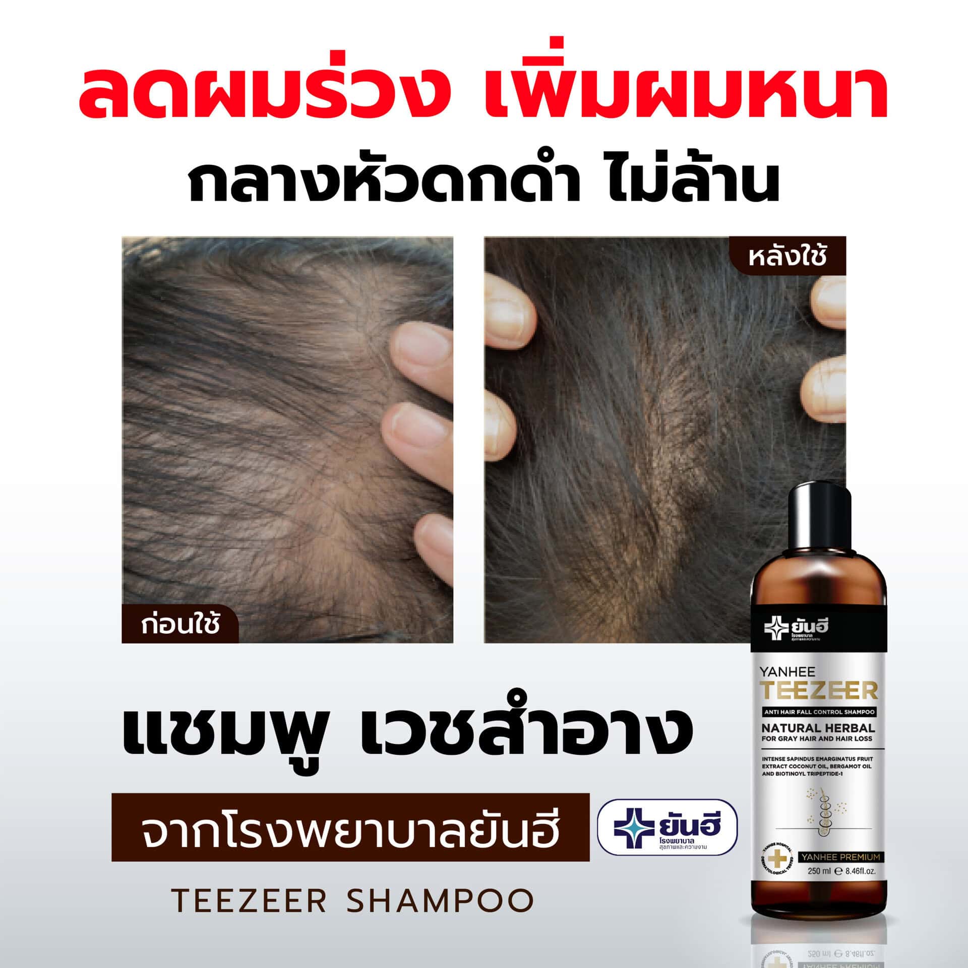 BEFORE AFTER SHAMPOO 01 0 scaled