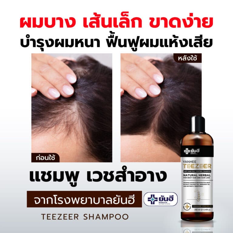 BEFORE AFTER SHAMPOO 02 0