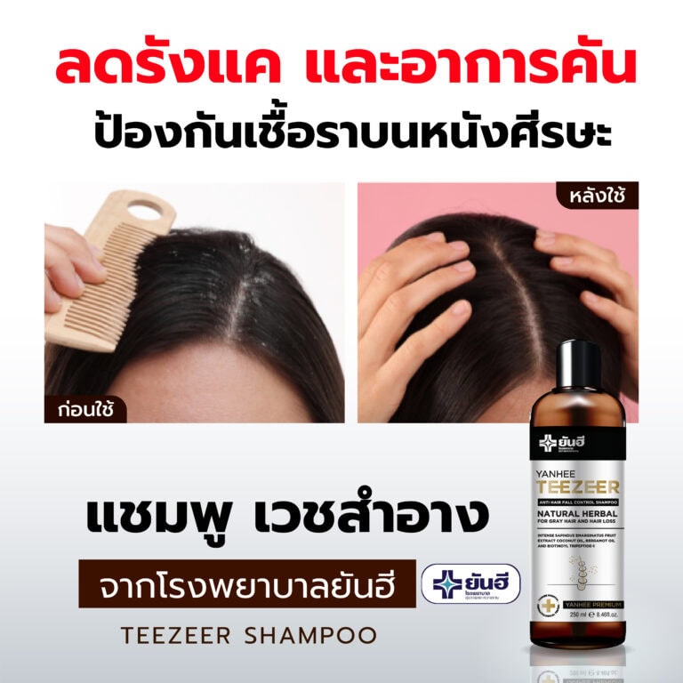 BEFORE AFTER SHAMPOO 04 0