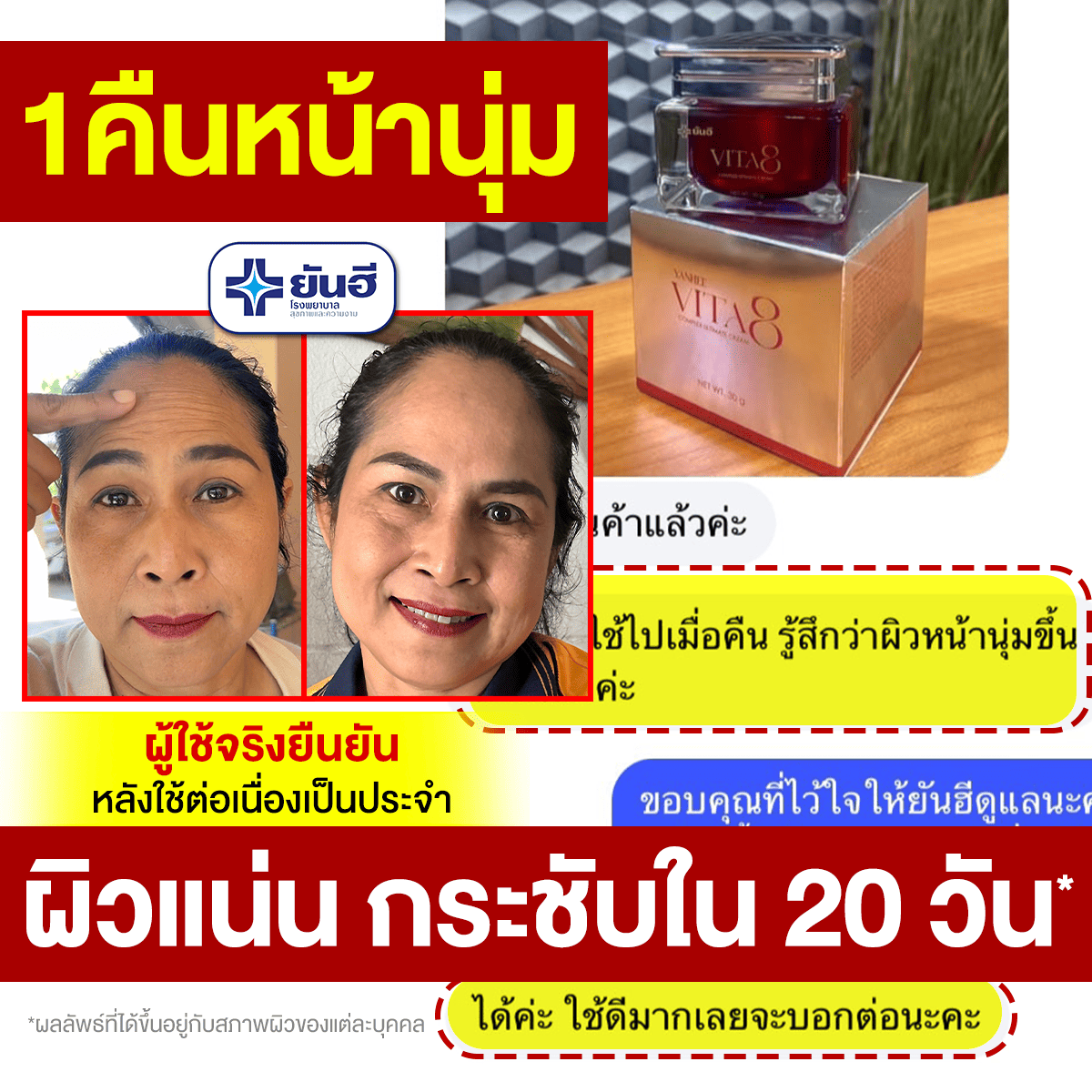 REVIEW VITA25 MAR02