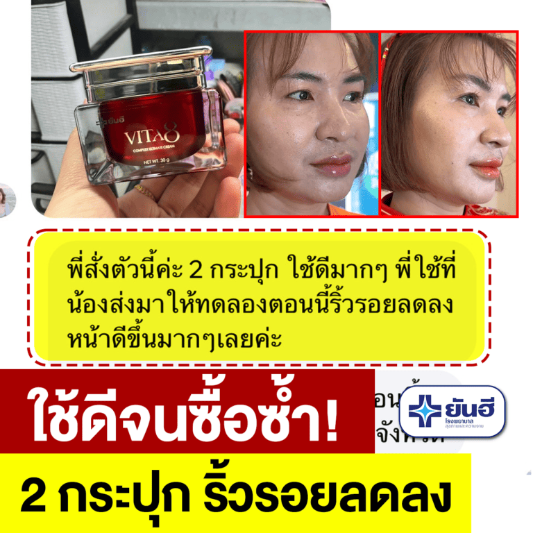 REVIEW VITA25 MAR06